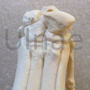 mano de lobo Ulnae Bones