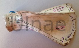 escapula ulnae bones