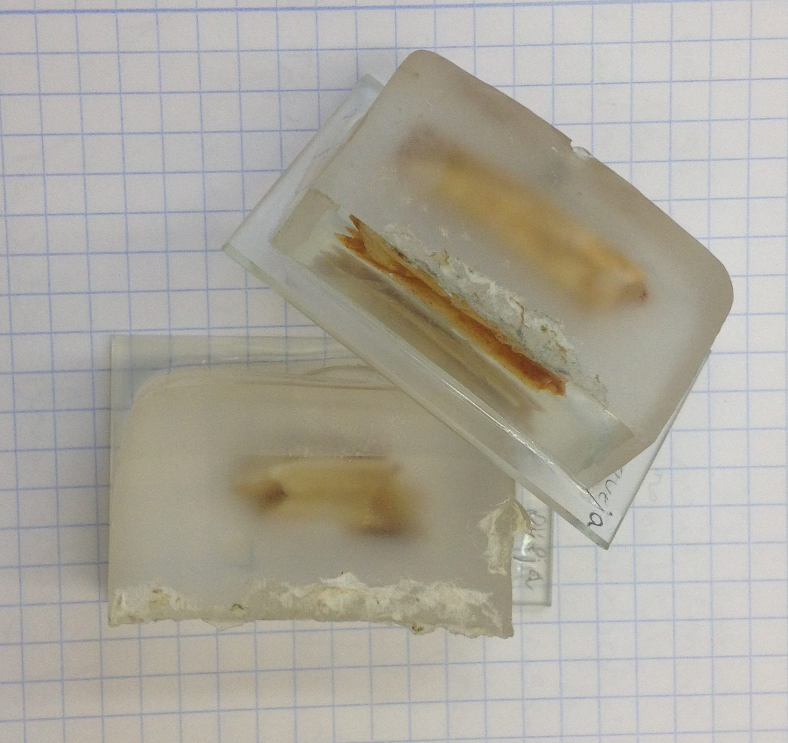 lamina delgada ulnae bones